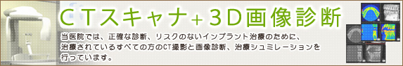 CTスキャナ＋3D画像診断 当医院では、正確な診断、リスクのないインプラント治療のために、
治療されているすべての方のCT撮影と画像診断、治療シュミレーションを
行っています。